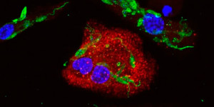 “Ardiloso”, parasita da leishmaniose manipula defesas para manter replicação, diz estudo