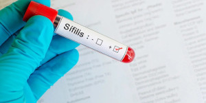 Casos de sífilis aumentam 84,7% em São Carlos e 91,4% em São João da Boa Vista