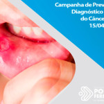 Campanha de Prevenção e Diagnóstico Precoce do Câncer Bucal terá início segunda-feira (15.04)